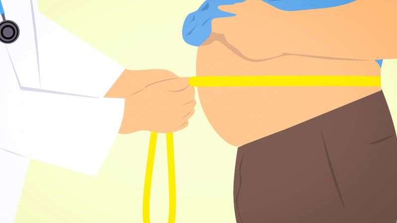 مريض بحاجة الى عملية شفط الدهون لتقليل وزنه في منطقة المعدة
